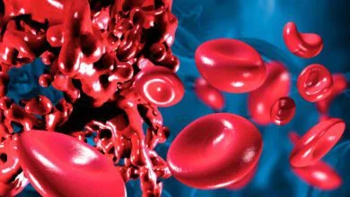 صورة تعبيرية (مواقع)