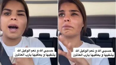 شاهد: انهيار بلوقر كويتية بعد تشوه وجهها بسبب هذا النوع من...