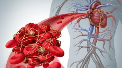 احذر.. هذه الأطعمة &apos;تمنع الدم من الحركة&apos; وتسبب جلطات دموية...