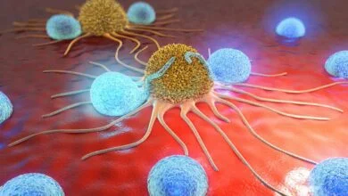 من كان يصدق!.. علاج جديد 'معجزة' لمرضى السرطان يعمل على تقليص...