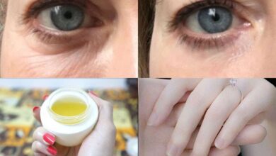 بالفيديو: صيدلي سعودي يكشف عن كريمات لإزالة التجاعيد حول...