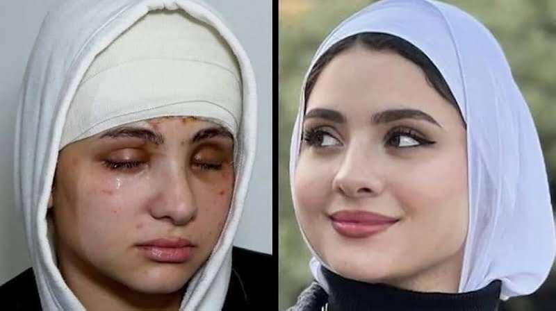 بلوجر سارة2 مساحة نت | خبر صادم جديد حول البلوغر سارة بعد العملية الجراحية في عينيها.. تفاصيل