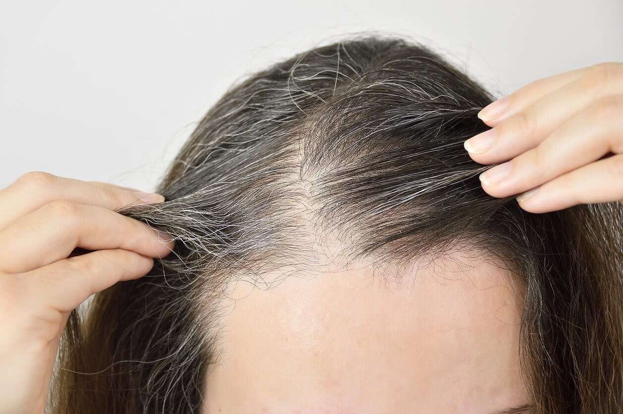Young woman shows her gray hair مساحة نت | اعملي وصفة القرنفل الطبيعية للتخلص من الشيب المبكر خلال وقت قصير.. فعالة وآمنة