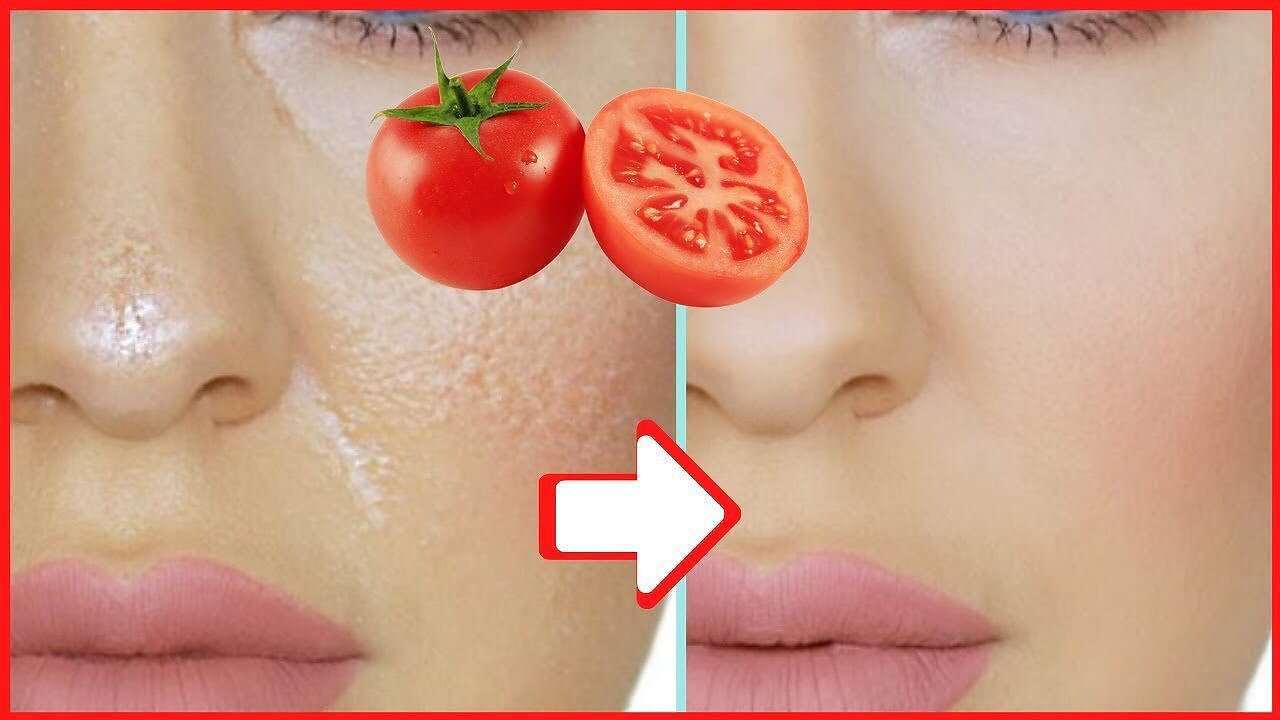 ماسك طماطم مساحة نت | بحبة طماطم.. اعملي ماسك سحري لتنظيف البشرة من الرؤوس السوداء والنمش والكلف وآثارهم