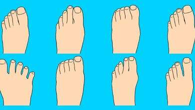 شل القدم (مواقع)