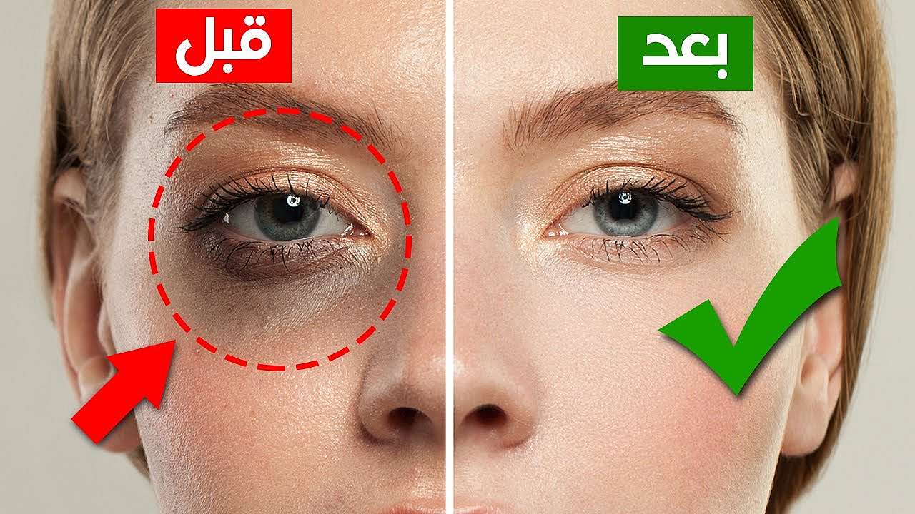 هالات هالات سوداء (مواقع)