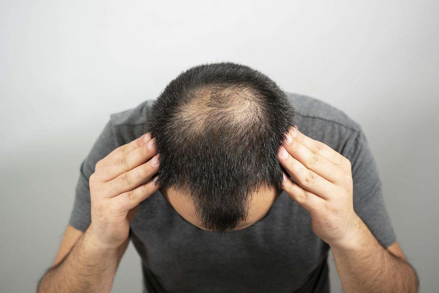 الكشف عن عصير طبيعي يعيد نمو الشعر عند تدليك المناطق الصلعاء.. خلال شهرين