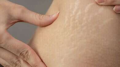 صورة تعبيرية (مواقع)