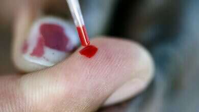 صورة تعبيرية (مواقع)