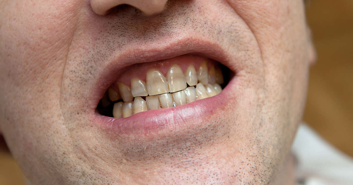 أسنان صورة تعبيرية (مواقع)