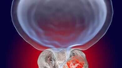 صورة تعبيرية (مواقع)