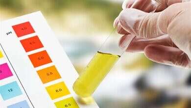 صورة تعبيرية (مواقع)